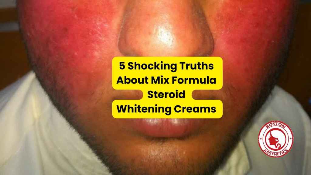 Painful skin reaction showing the harsh truths about mix formula steroid whitening creams commonly used in Lahore for skin lightening