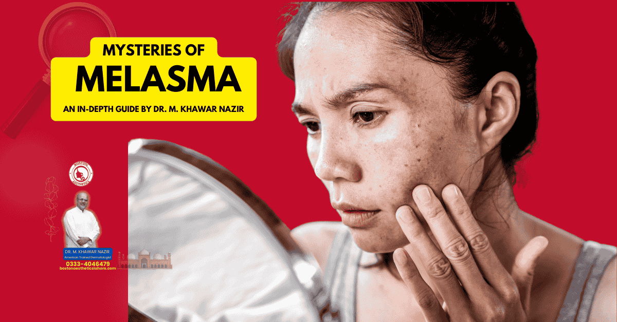 Woman examining her facial skin in the mirror, concerned about melasma, with a background featuring Dr. M. Khawar Nazir's guide on understanding and treating the condition.
