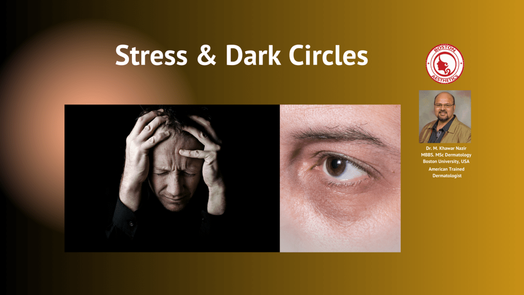 Role Of Stress in Dark Circles | Dr. M. Khawar Nazir