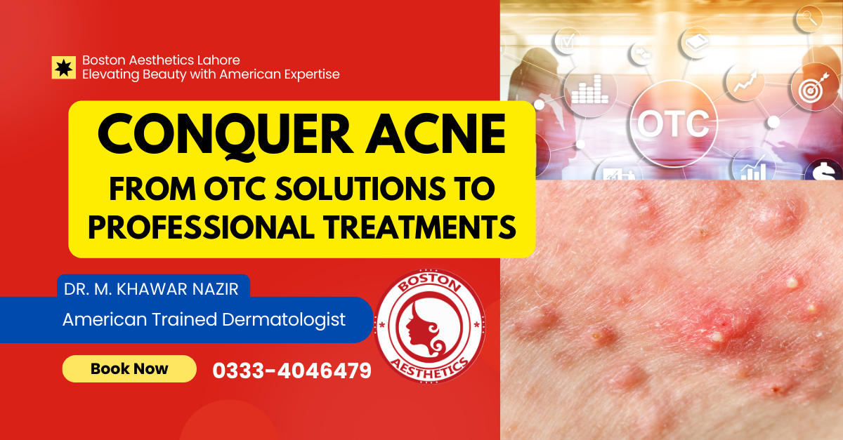 Conquer Acne: From OTC Solutions to Professional Treatments