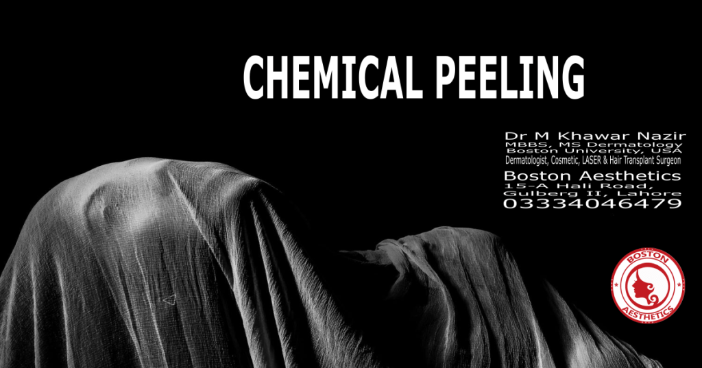 Chemical Peeling offers wonders to skin regarding pigmentation, open pores, uneven tone & anti aging impacts.