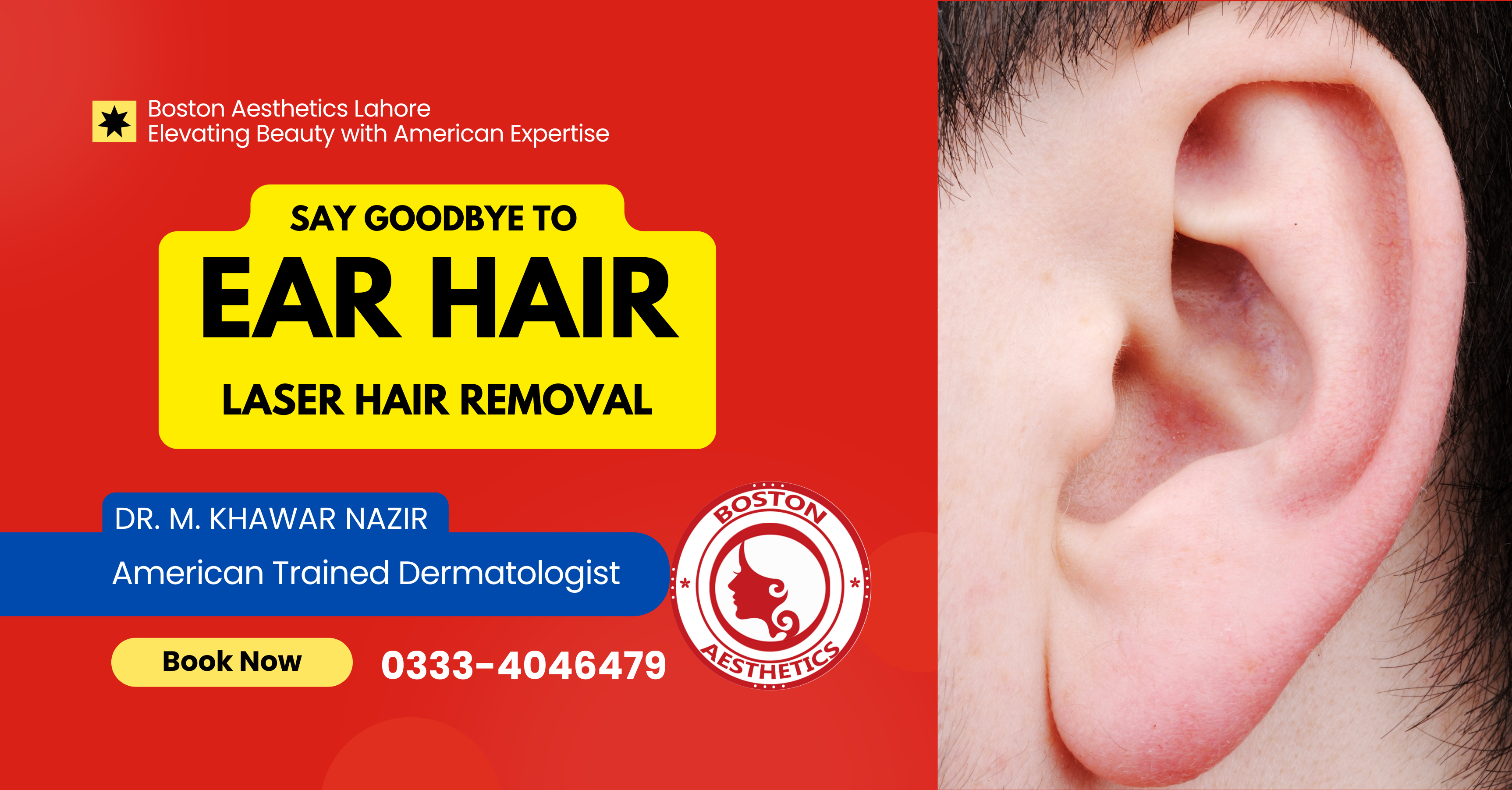 Best LASER Hair Removal for Ears in Lahore