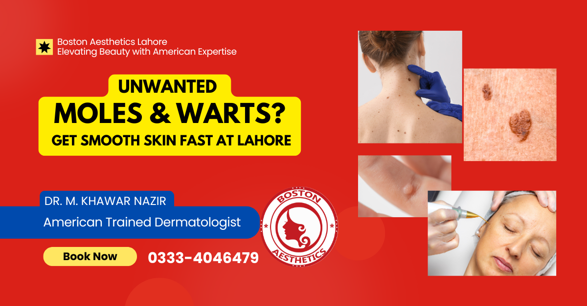 Remove Moles & Warts, Restore Smooth Skin