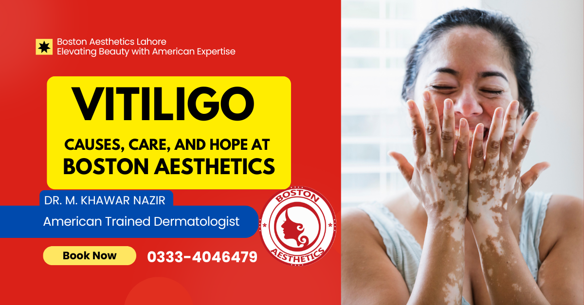 Vitiligo: Comprehensive Management in Lahore