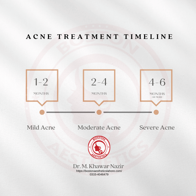 Research-based statistics on average treatment times for each level of acne