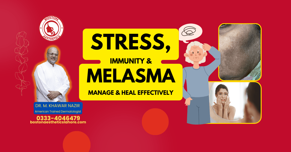 Stress, Immunity, Healing & Melasma