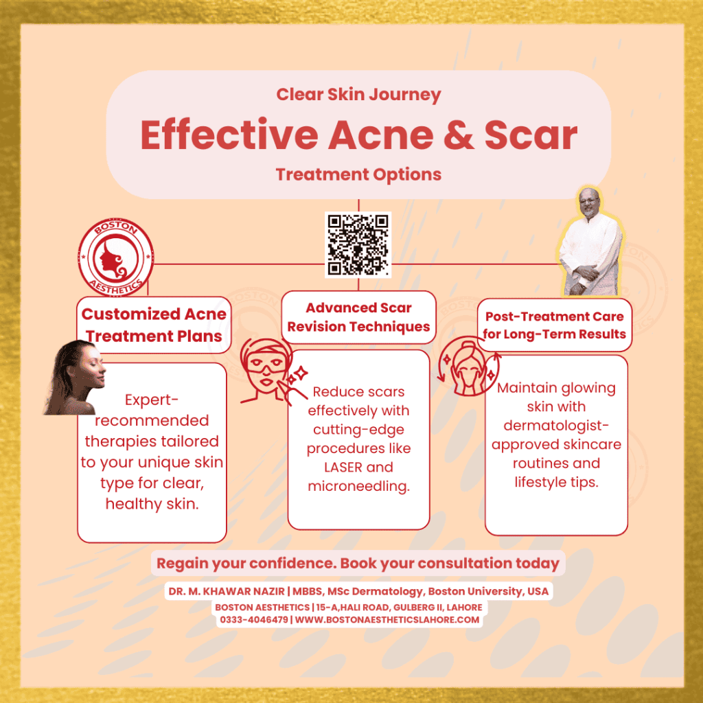 Infographic showcasing effective acne and scar treatment options by Dr. M. Khawar Nazir at Boston Aesthetics, Lahore. The infographic highlights customized acne treatment plans, advanced scar revision techniques, and post-treatment care for long-term results, featuring clinic details and contact information.