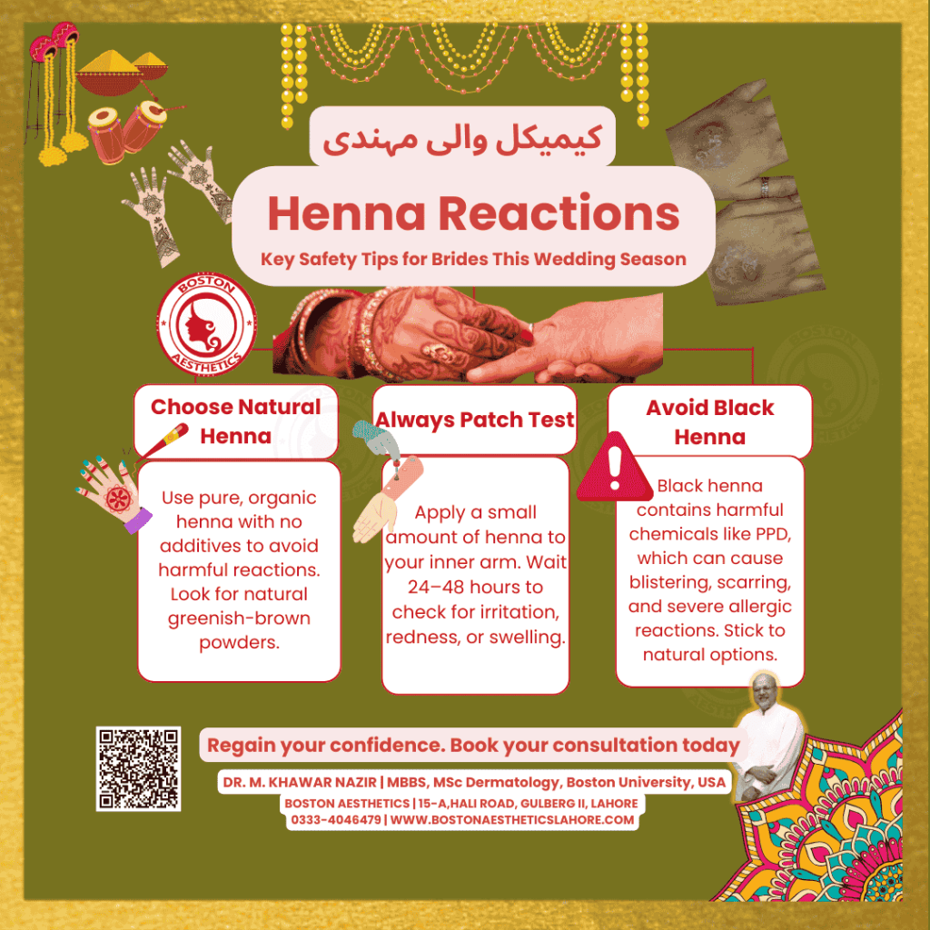 Infographic by Dr. M. Khawar Nazir at Boston Aesthetics, Lahore, providing safety tips for avoiding chemical henna reactions. Includes advice to choose natural henna, conduct a patch test, and avoid black henna, tailored for brides this wedding season.