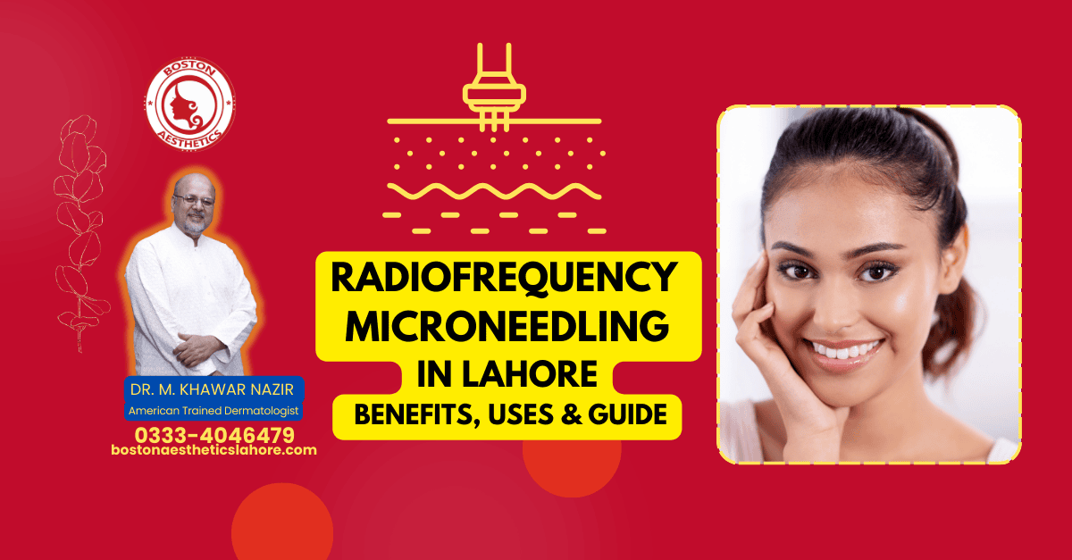 RF Microneedling in Lahore by Dr. M. Khawar Nazir at Boston Aesthetics, highlighting benefits, uses, and expert care for skin rejuvenation.