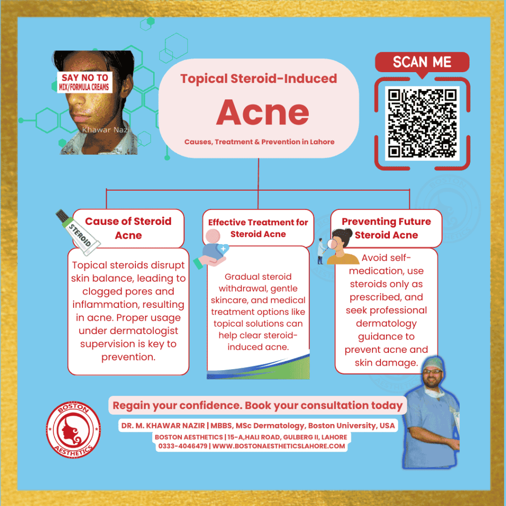 Infographic on topical steroid-induced acne. Dr. M. Khawar Nazir explains causes, treatment options, and how to prevent future steroid acne. Boston Aesthetics, Lahore.