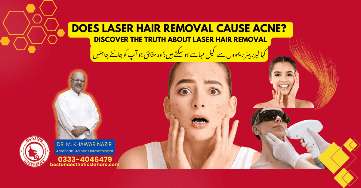 Laser hair removal treatment with acne concerns, featuring Dr. M. Khawar Nazir, American-trained dermatologist in Lahore. Get the facts about skin care.