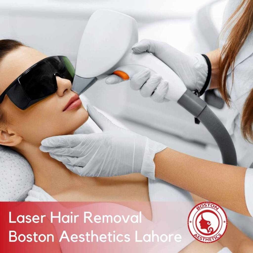 Laser hair removal in Lahore being performed on a woman’s upper lip at Boston Aesthetics for smooth, confident, hair-free skin by certified American-trained experts