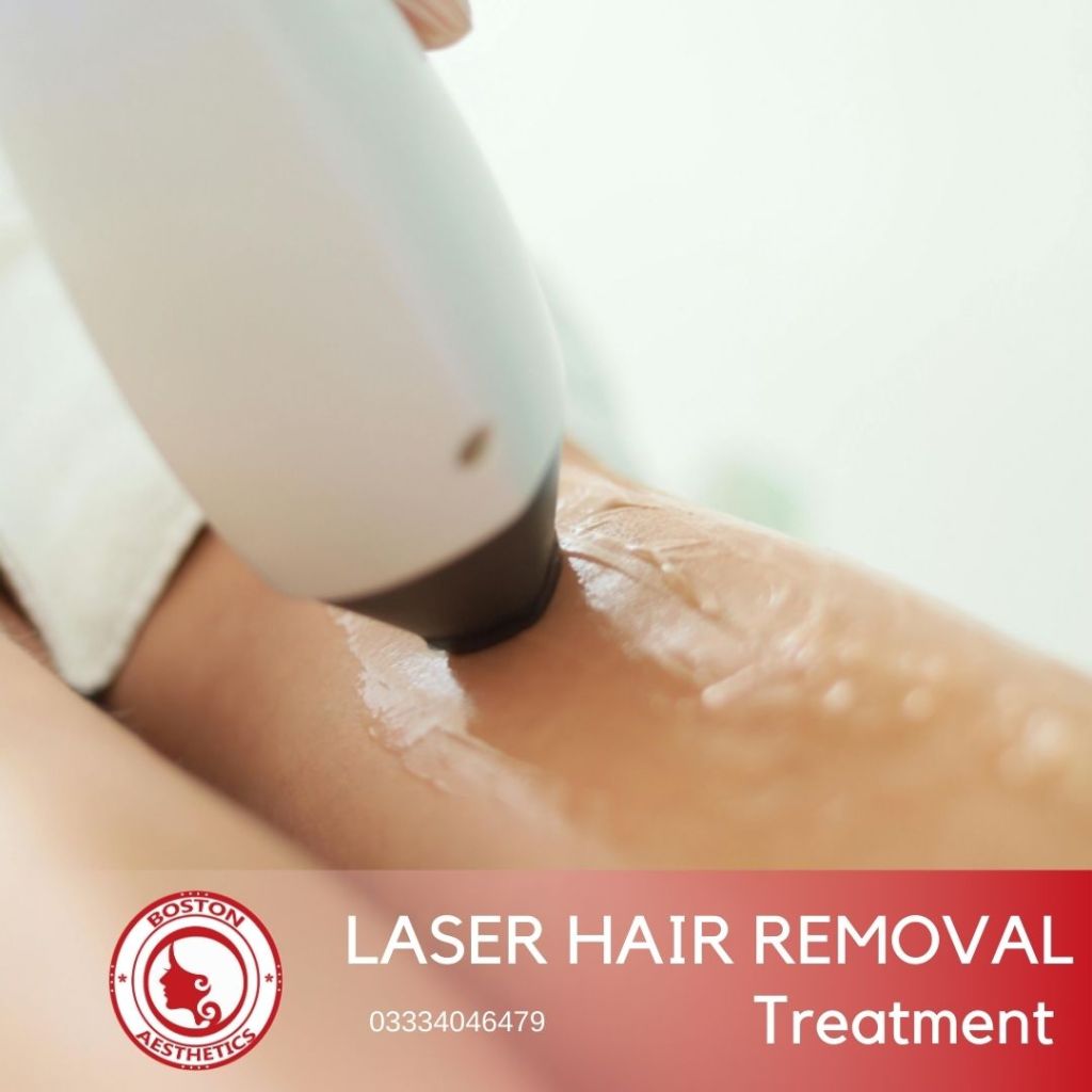 Close-up of a laser hair removal session on legs at Boston Aesthetics in Lahore, providing safe, smooth, and long-lasting hair reduction for women