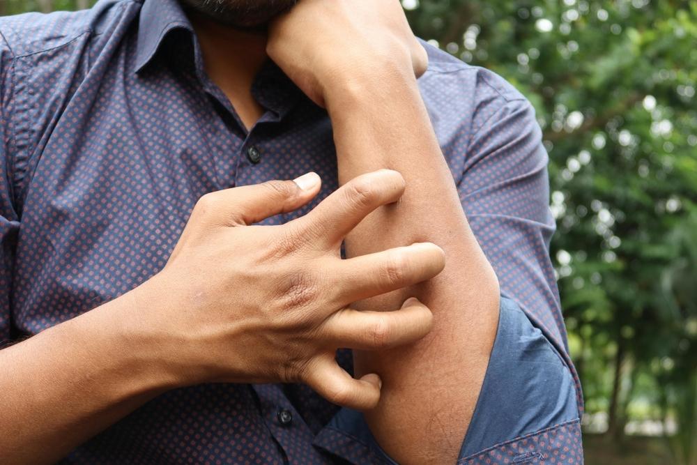 A man scratching his arm, possibly due to eczema or fabric irritation. Wearing breathable cotton can help minimize eczema-related itching.