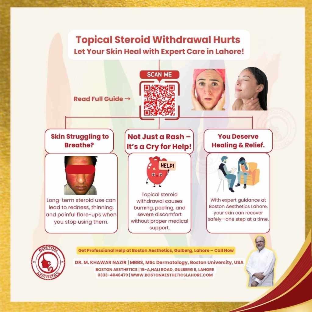 Infographic showing 3 signs of topical steroid withdrawal including skin thinning, burning, and discomfort with expert healing options at Boston Aesthetics Lahore