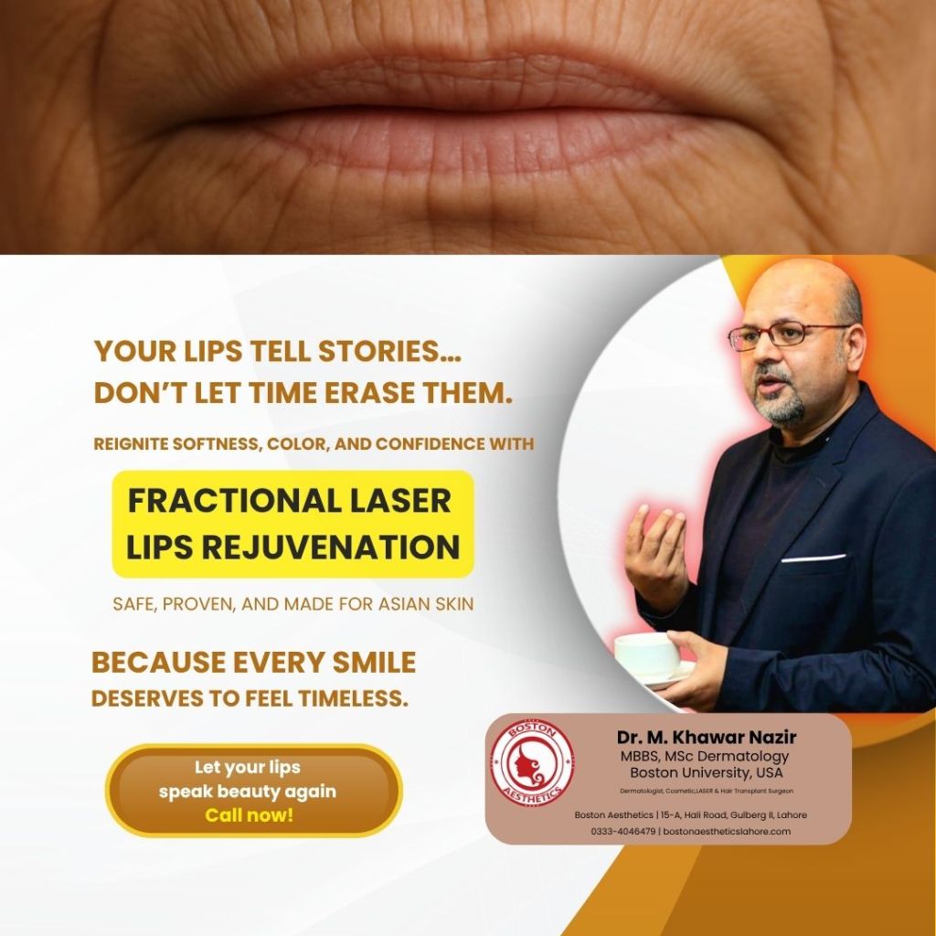 Poster on fractional laser lip rejuvenation with Dr. Khawar Nazir, promoting soft, youthful lips for Asian skin at Boston Aesthetics Lahore.