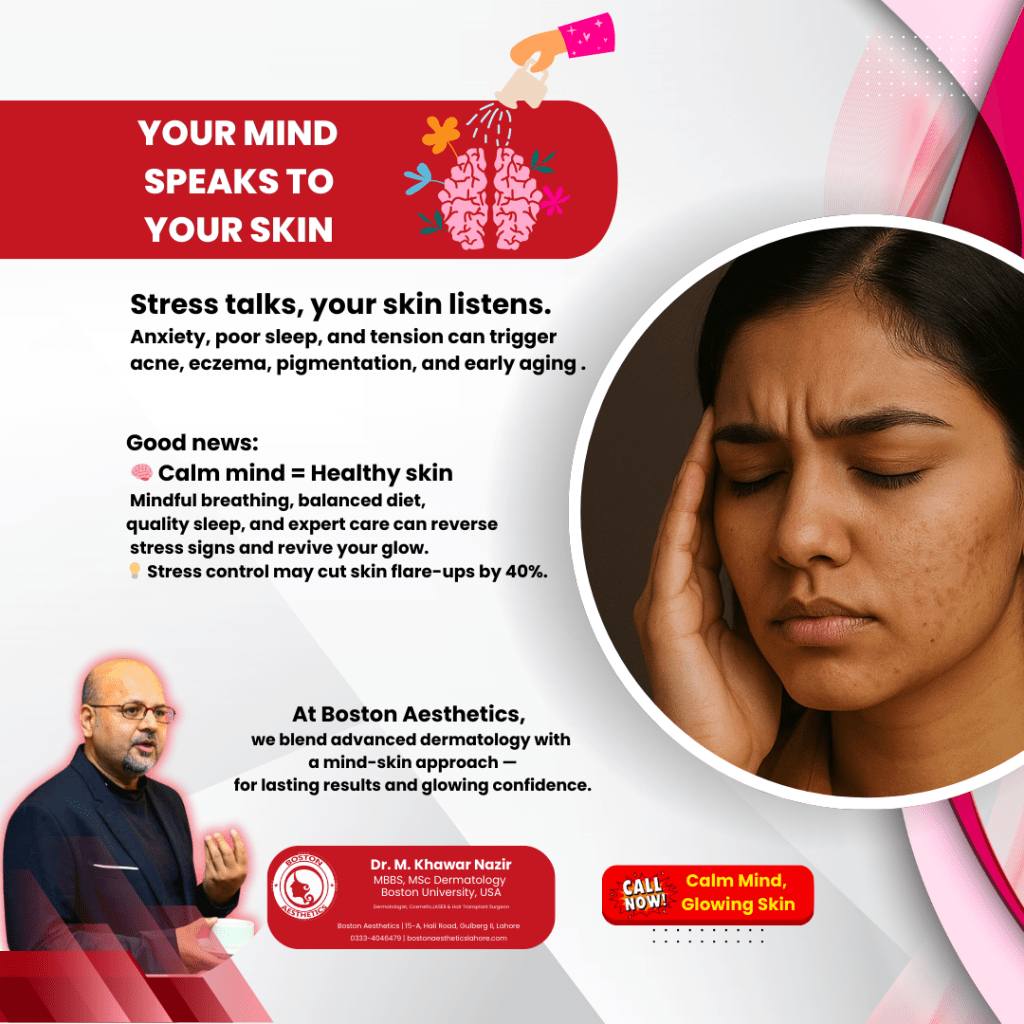 Educational poster showing the link between stress and skin health, featuring Dr. M. Khawar Nazir and a Pakistani woman with visible stress-related skin concerns, promoting advanced dermatology care in Lahore.